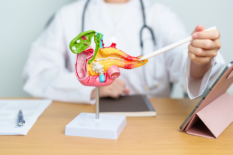 Dokter Harvard Ungkap Gejala Tersembunyi Kanker Pankreas yang Perlu Diwaspadai